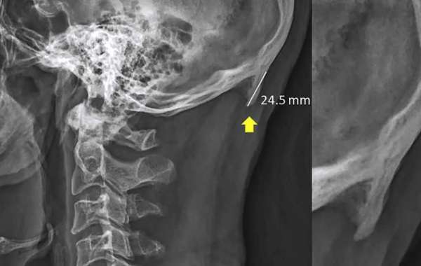 As transformações do corpo com a evolução da tecnologia